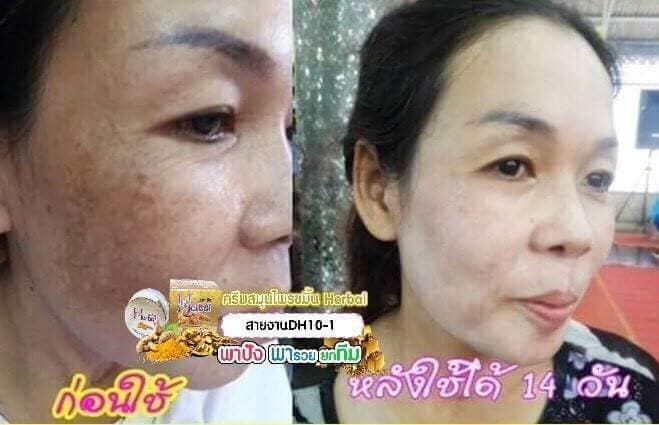 SNAIL WHITE SOAP GLUTATHIONE X10 WHITENING SKIN/REDUCE ACNE/ANTI AGING